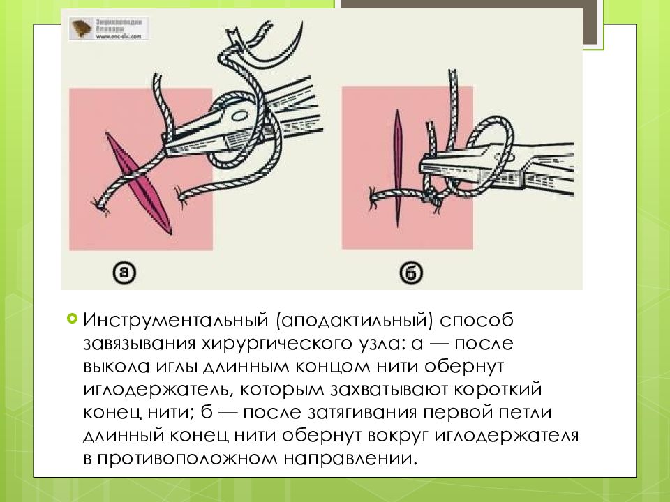 Схема хирургических швов