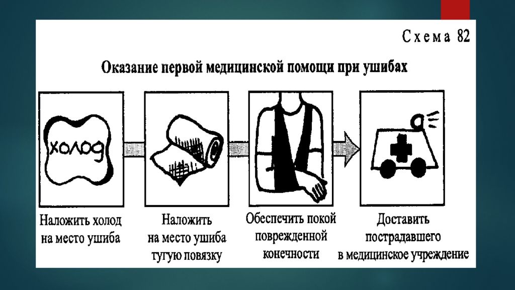 Оказание первой помощи при повреждении мышц. Первая помощь при ушибах растяжениях и разрывах связок. ПМП при ушибах и растяжениях. Порядок оказании первой помощи при ушибах вывихах и растяжениях. Алгоритм оказания первой помощи при ушибах, вывихах и переломах.