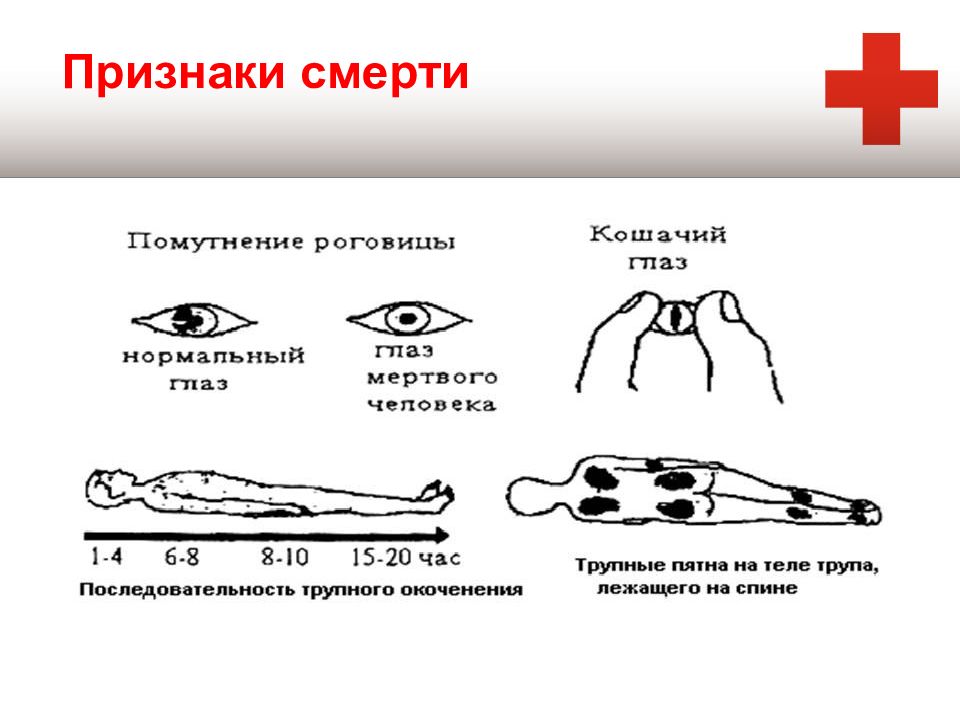 2 признаки жизни. Признаки смерти человека. Смерть признаки смерти. Признаки биологической смерти трупные пятна.