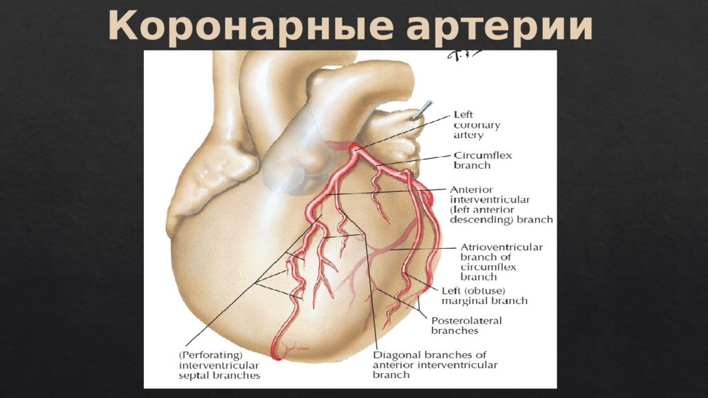 Коронарные артерии. Циркумфлекс коронарной артерии. Кардиохирургия презентация.