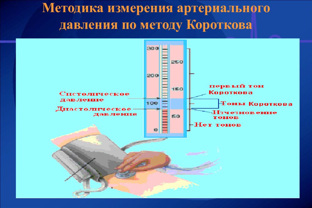 Метод давления. Методика измерения ад по методу Короткова. Методика измерения артериального давления по методу Короткова. Метод Короткова для измерения артериального давления алгоритм. Методика измерения артериального давления по Короткову.