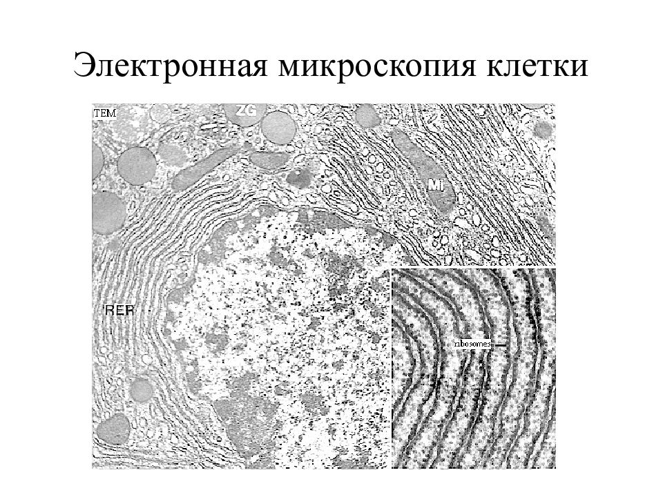 Электронная микроскопия. Клетки Пуркинье электронная микроскопия микроскопия. Электронный микроскоп ЕГЭ. Срез для электронной микроскопии. Клетка в электронном микроскопе.