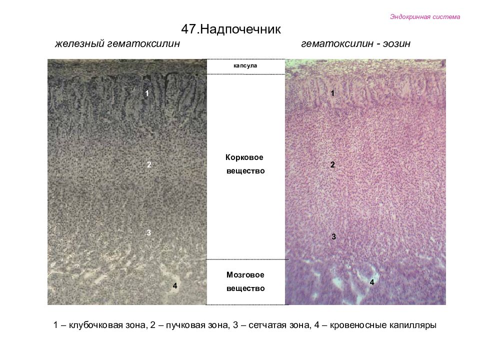 Кровоизлияние в надпочечник микропрепарат рисунок