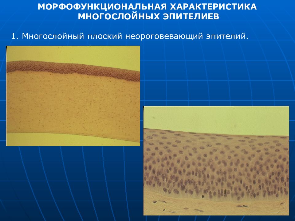 Многослойный плоский неороговевающий эпителий. Многослойный плоский неороговевающий эпителий функции. Многослойный плоский неороговевающий эпителий локализация. Многослойный кубический неороговевающий эпителий.