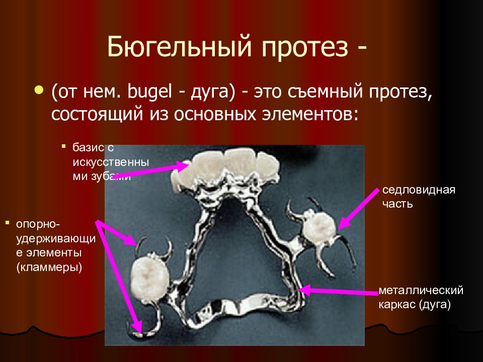 Клинико лабораторные этапы изготовления бюгельных протезов презентация