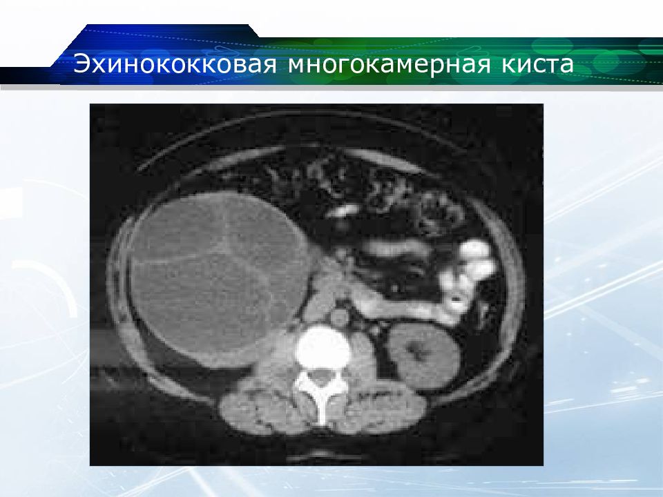 Кт почек презентация