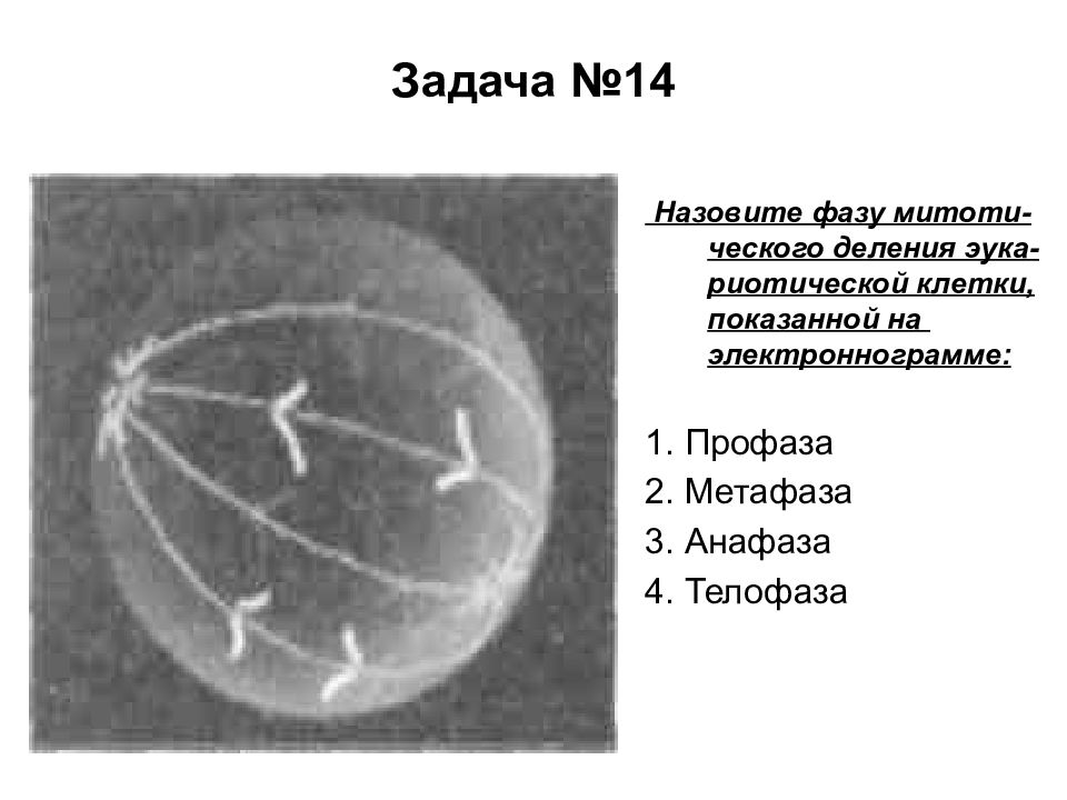 Анафаза строение. Строение интерфазного клеточного ядра. Метафаза 3. Интерфазная ядро электронная микрофотография.