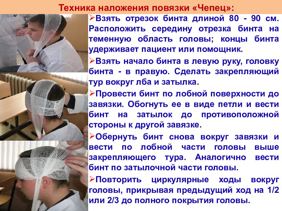 Техника наложения повязки чепец. Чепец медицинский перевязка. Наложение повязки Черепец. Наложение повязки чепец. Повязка чепец техника.