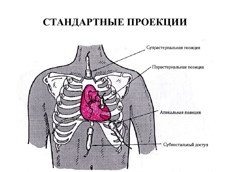 Парастернальная линия это