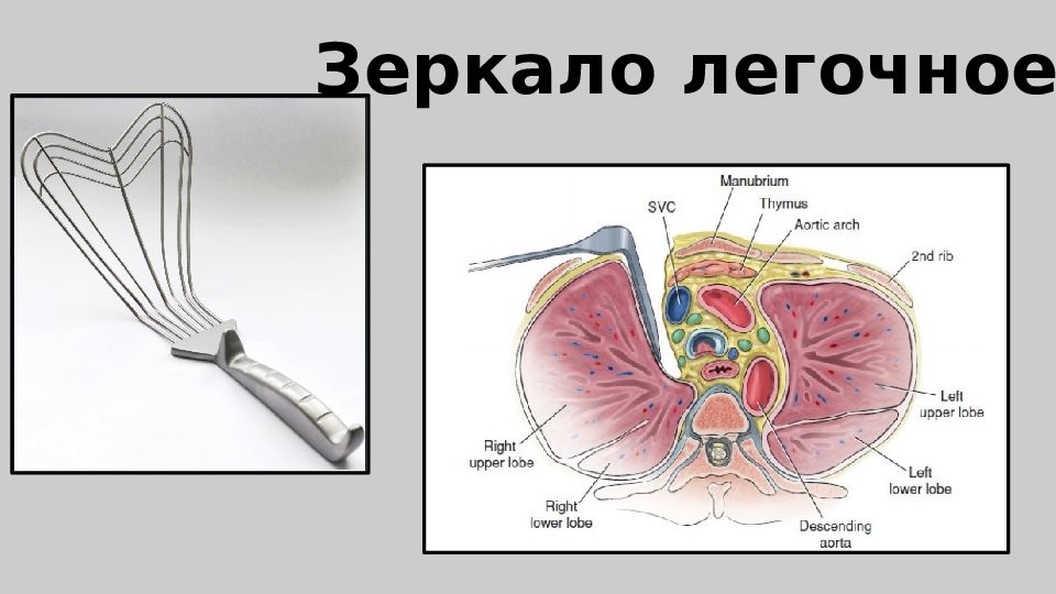 Торакальная хирургия презентация