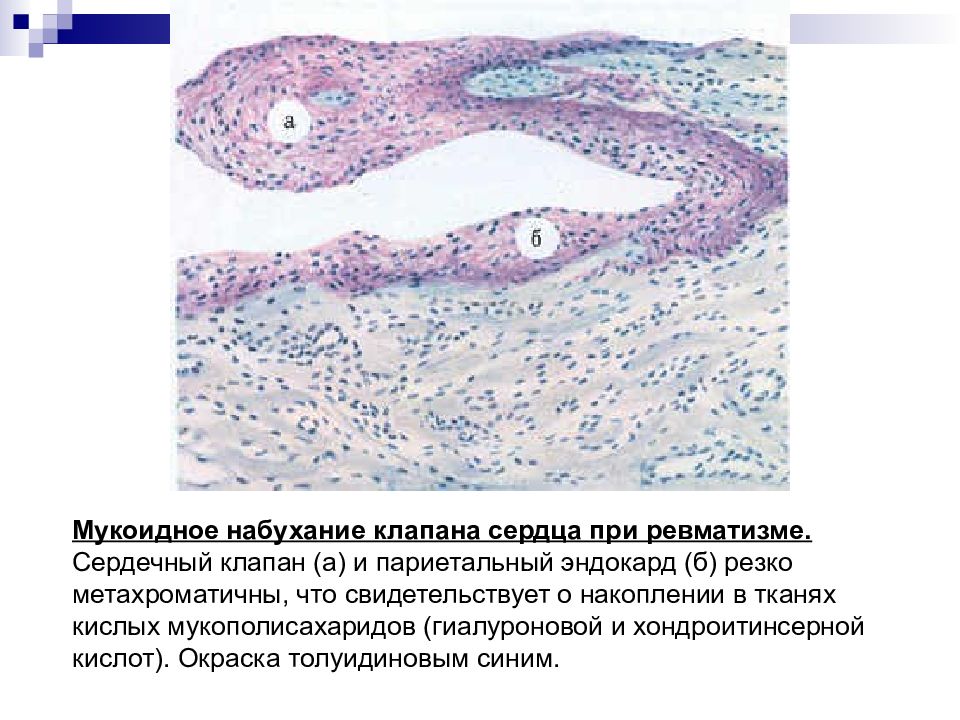 Митральный клапан гистология рисунок