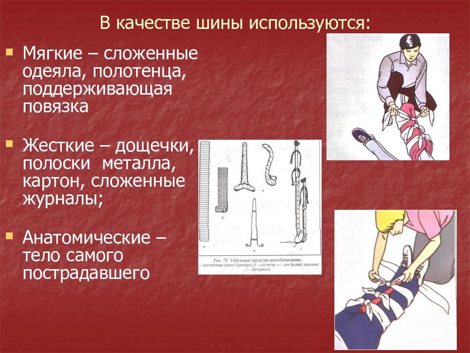 Первая помощь при травмах обж презентация