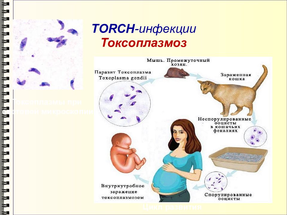 Торч инфекции презентация