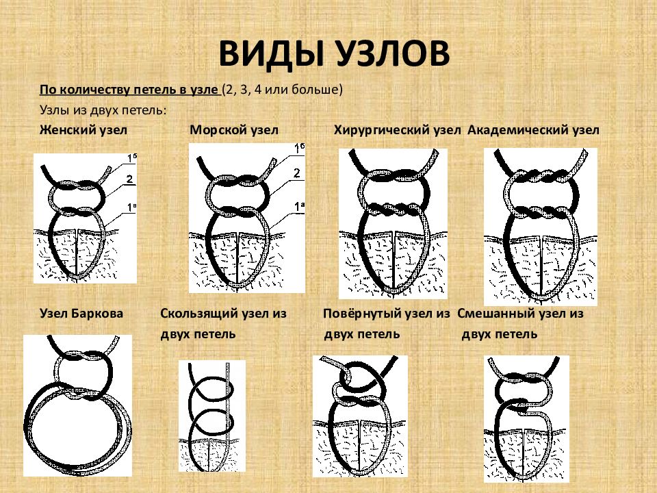 Операция узел. Хирургические узлы техника. Морской узел хирургия техника. Хирургические узлы классификация. Простой морской и хирургический узлы.