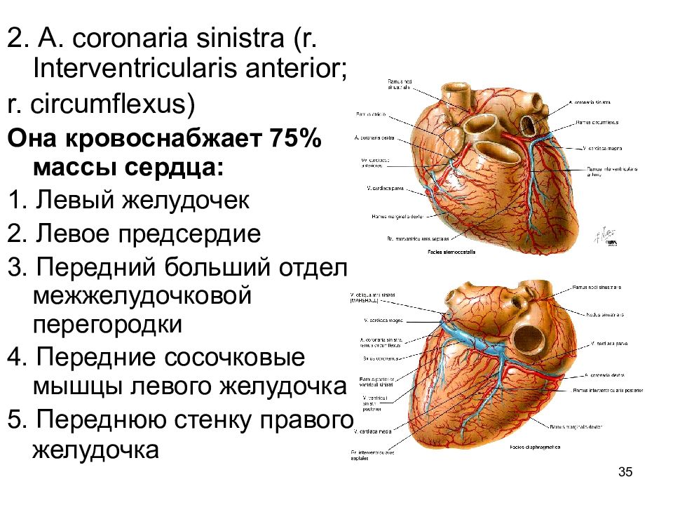 Правая сосочковая мышца. R interventricularis anterior. Межжелудочковая борозда. Сосочковые мышцы сердца.