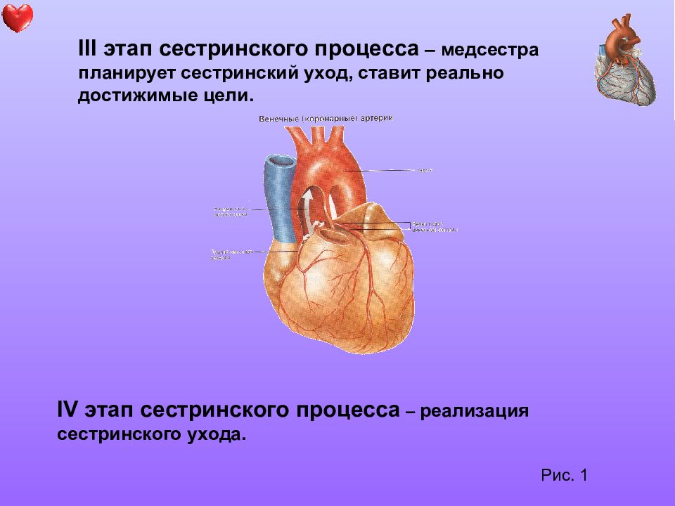 Сестринский процесс при ишемической болезни сердца презентация