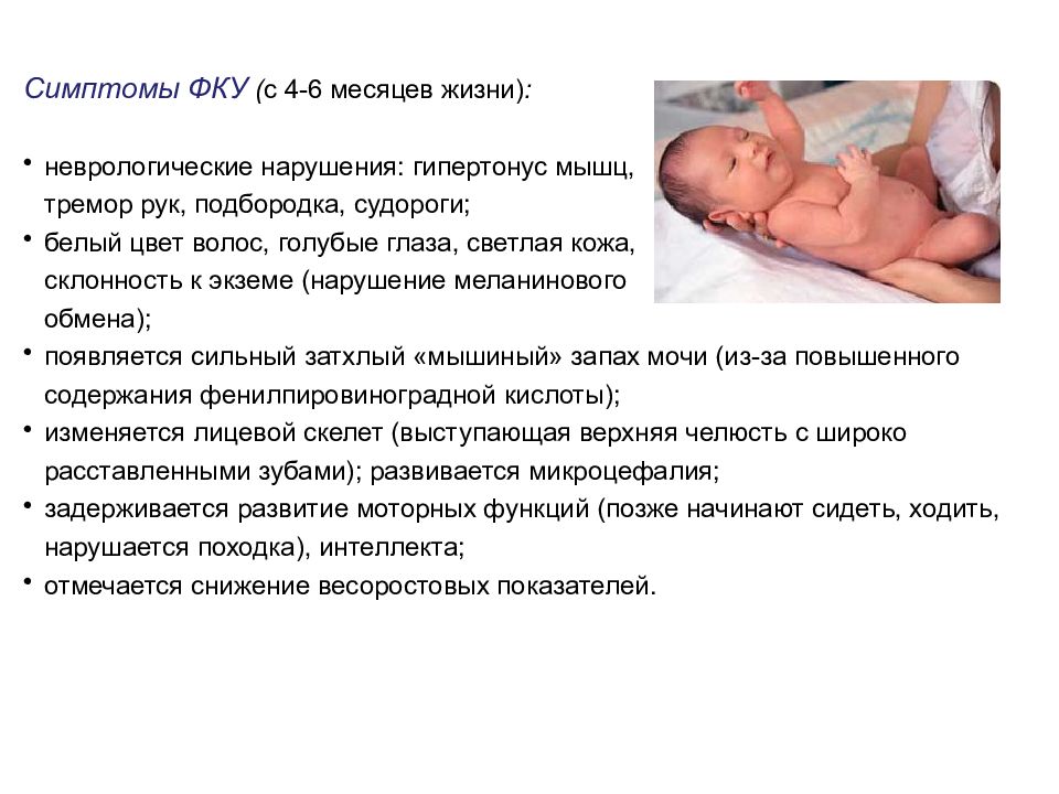 5 заболеваний новорожденных. Болезни новорожденных сестринский уход. Врожденные заболевания новорожденных. Наследственные и врожденные заболевания новорожденных. Тремор у новорожденного 2 месяца.