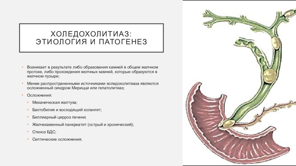 Холедохолитиаз факультетская хирургия презентация