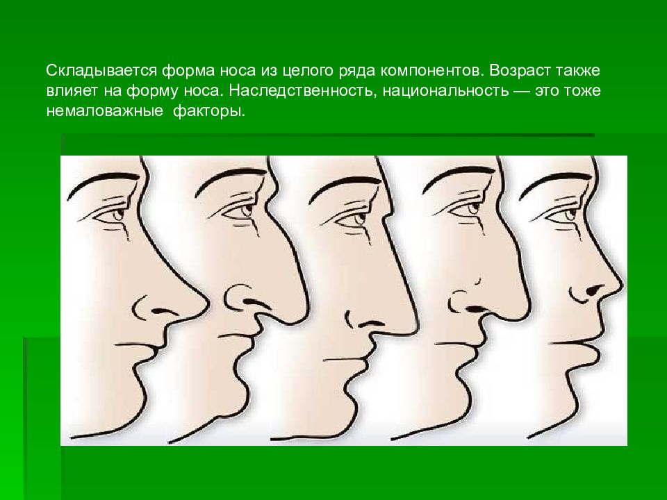 Виды носов. Формы носа. Типы Носов. Различные формы носа. Разные типы носа.