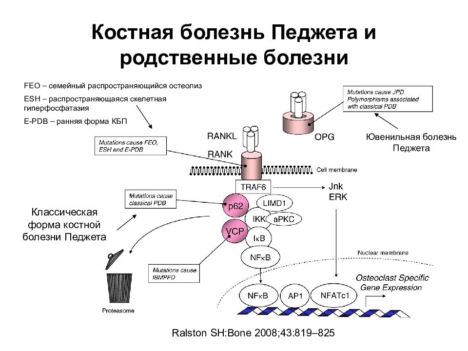 Болезнь педжета презентация