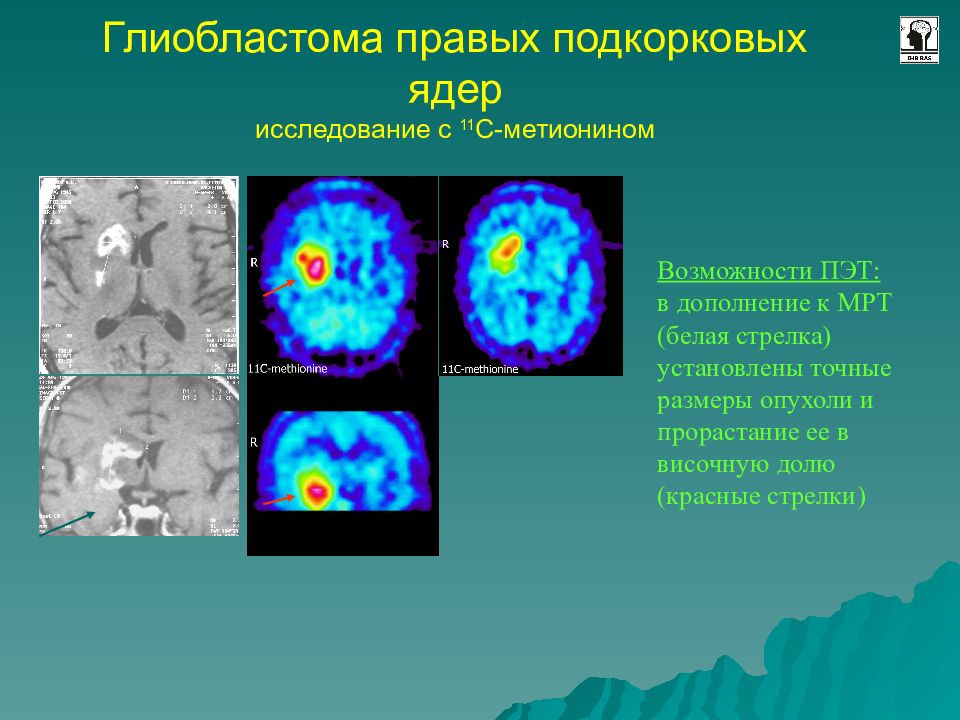 Лучевая диагностика нервной системы презентация