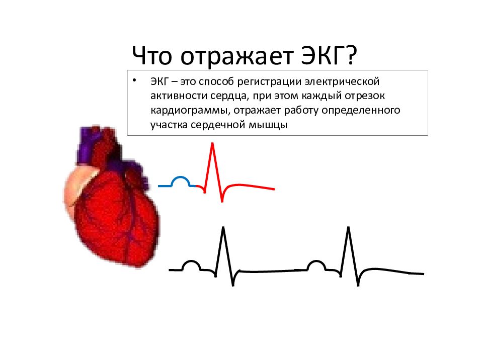 Презентация экг для студентов