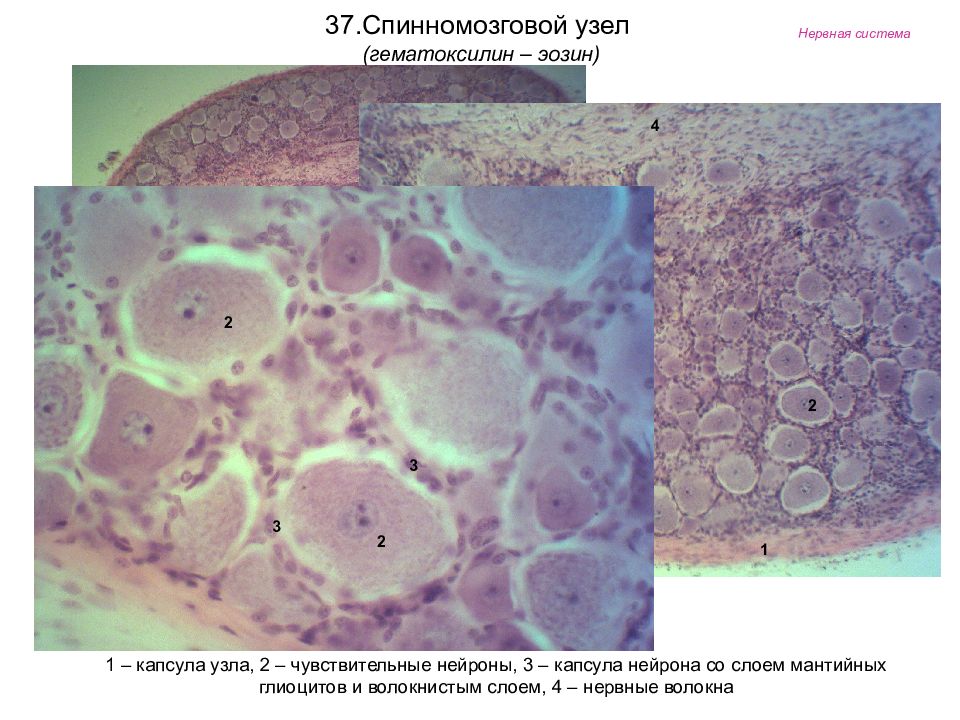 Спинальный ганглий гистология рисунок