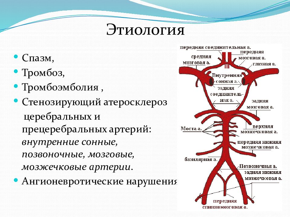 Схема тромбоза при атеросклерозе мозговых артерий