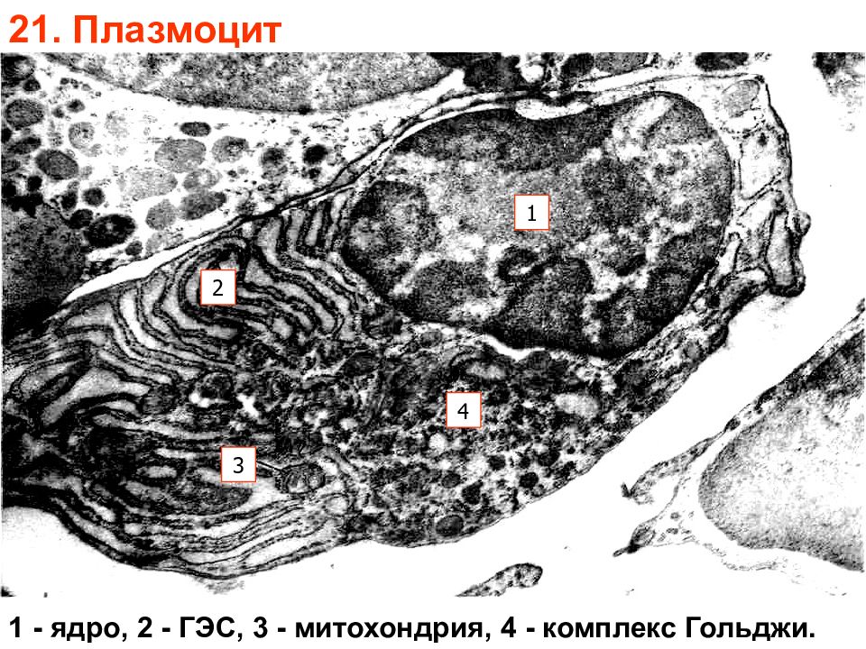 Фрагмент клетки. Аппарат Гольджи Электронограмма. Плазмоцит Электронограмма. Плазмоцит микрофотография. Фрагмент клетки комплекс Гольджи Электронограмма.