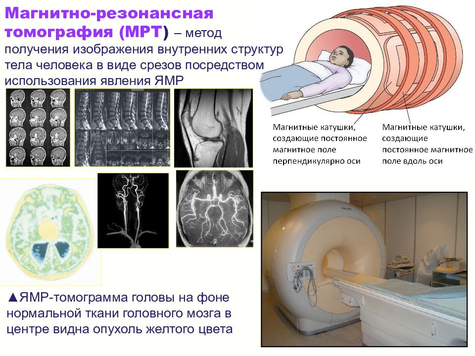 Метод магнитной томографии