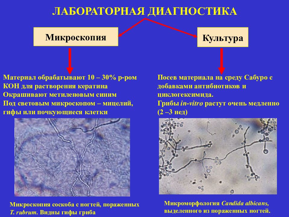 Схема микробиологической диагностики микозов