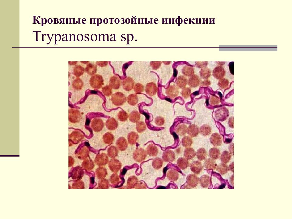 Кровяные инфекции. Протозойные кровяные инвазии. Возбудители протозойных инфекций. Возбудители протозойных инфекций кровяных инфекций. Протозоидные кровяные инфекции.