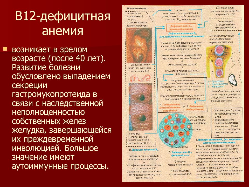 Дефицитная анемия. Болезнь крови анемия в12 дефицитная. B12 дефицитная анемия биохимия. Профилактика б12 дефицитной анемии. B12 дефицитная анемия клинические проявления.