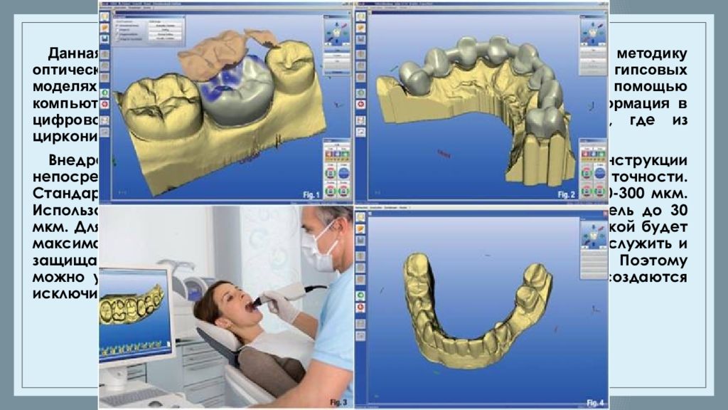 Cad cam технологии в ортопедической стоматологии презентация