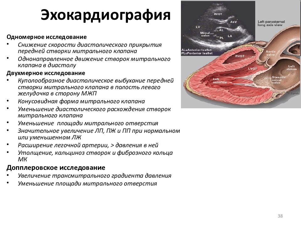 Митральный стеноз презентация