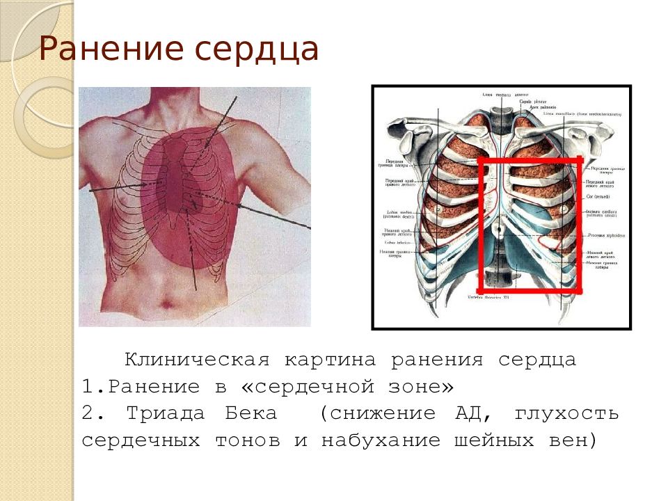 Картинки травма грудной клетки