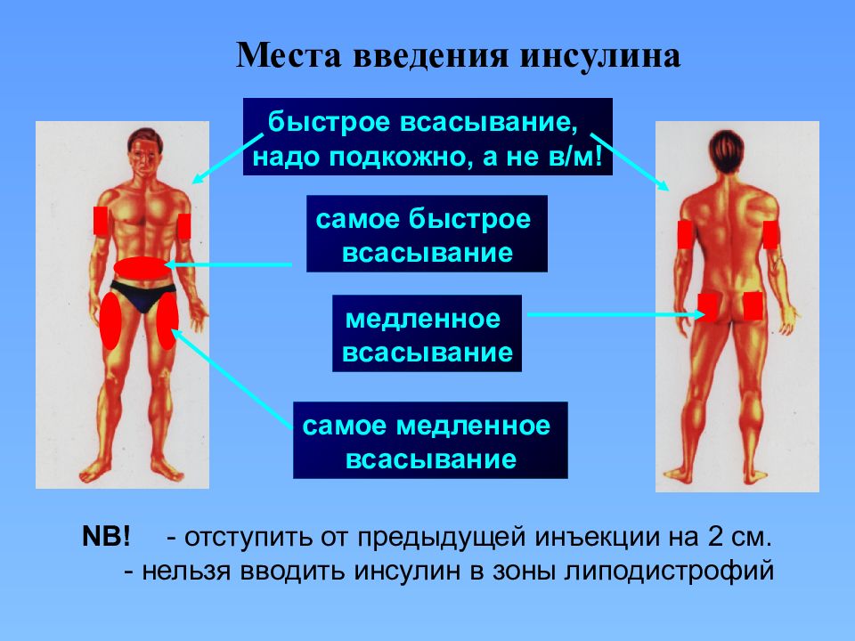 Рекомендуемые места. Места введения инсулина подкожно. Скорость всасывания инсулина. Места введения инсулина и скорость всасывания. Анатомические области введения инсулина.