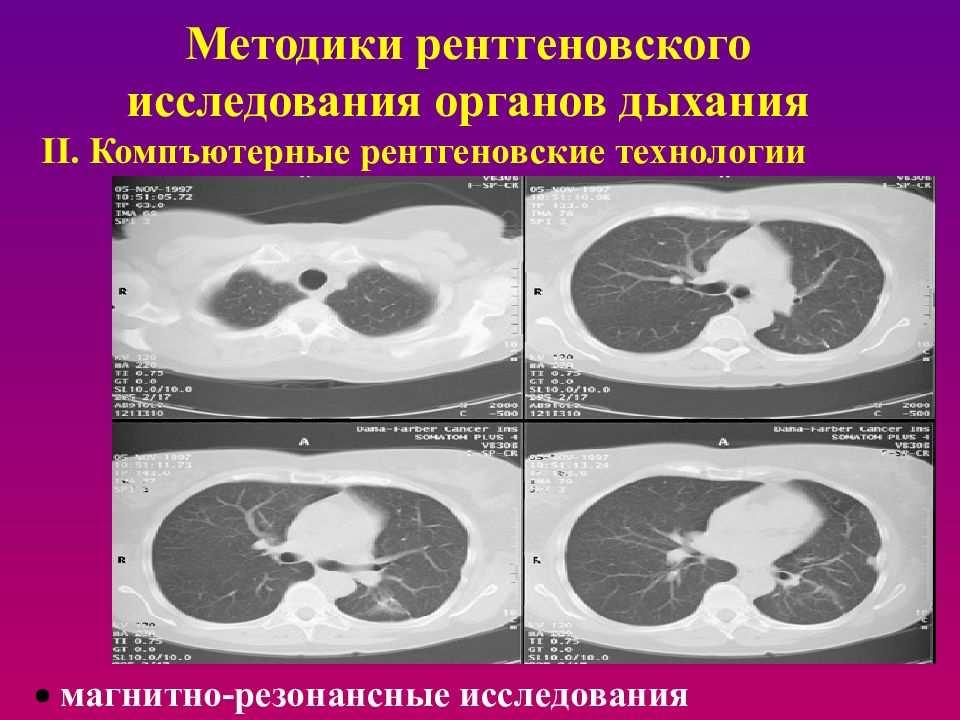 Методы лучевой диагностики органов дыхания презентация