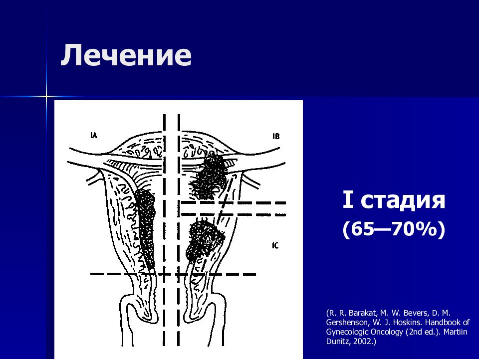 Злокачественные новообразования женских органов презентация