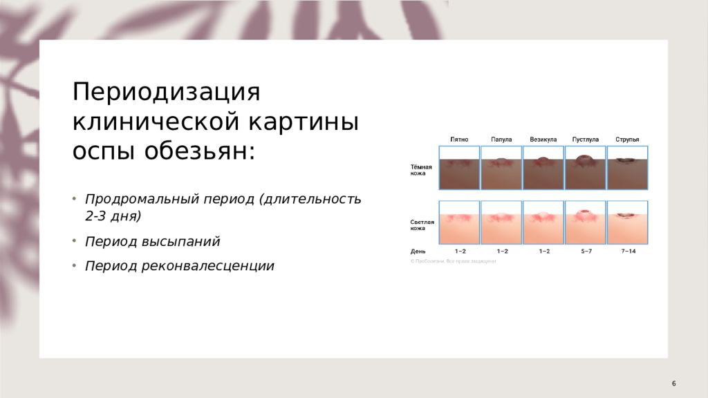 Оспа обезьян презентация