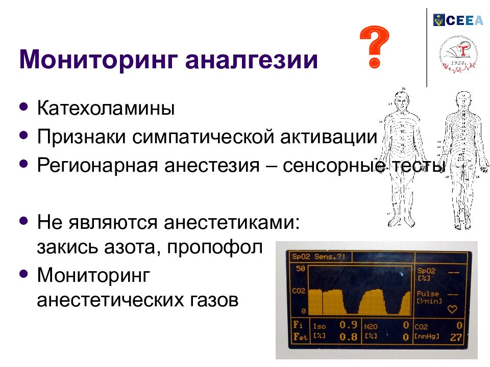 Мониторинг во. Мониторинг во время региональной анестезии. Тест-контроль тема «мониторинг во время анестезии». SPI мониторинг анестезиология нормы.