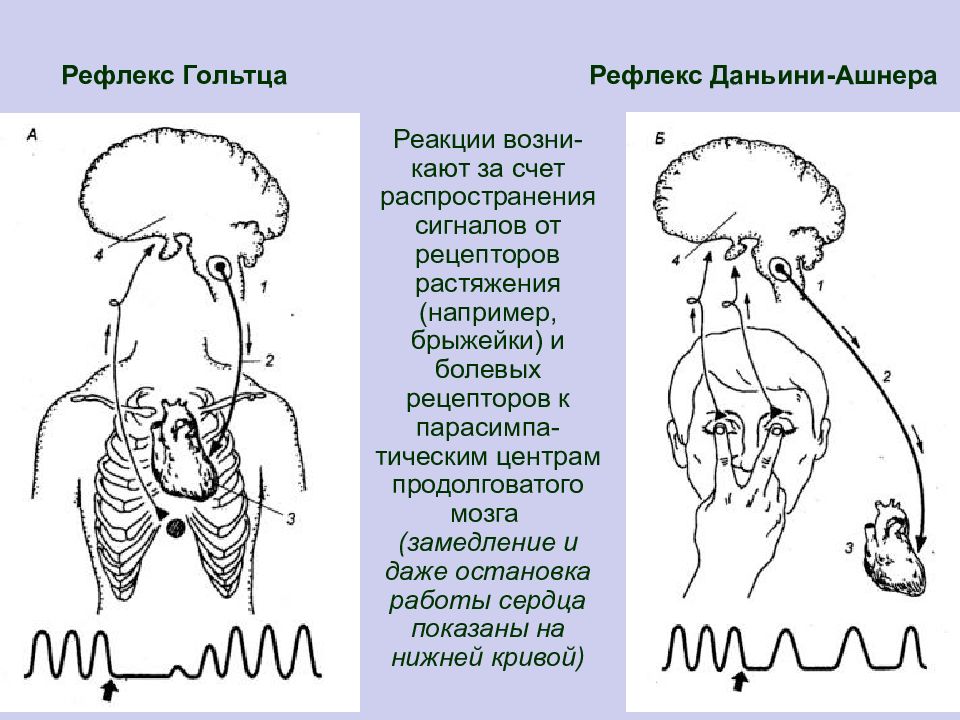 Глазосердечный рефлекс физиология схема