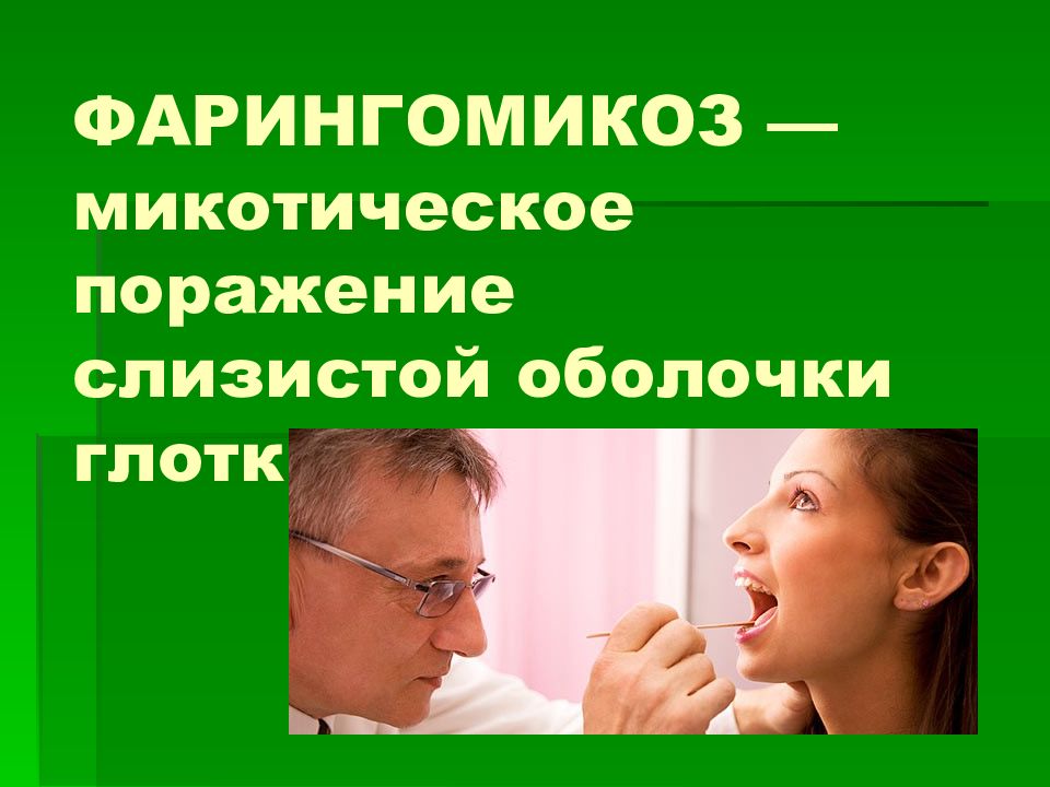ФАРИНГОМИКОЗ — микотическое поражение слизистой оболочки глотки.