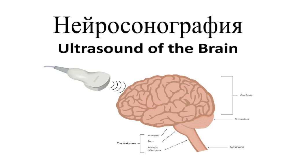 Нейросонография