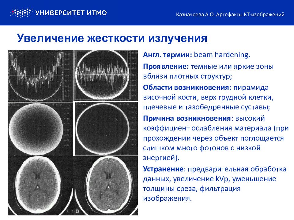 Артефакты кт изображений