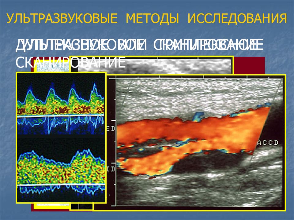 Ультразвуковые методы исследования. Виды ультразвуковых методов исследования. Ультразвуковой метод исследования составляют. Ультразвуковое методы исследования хирургических больных.