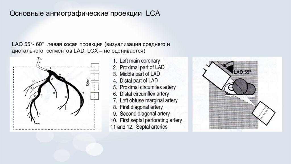 Рентгенэндоваскулярная диагностика презентация