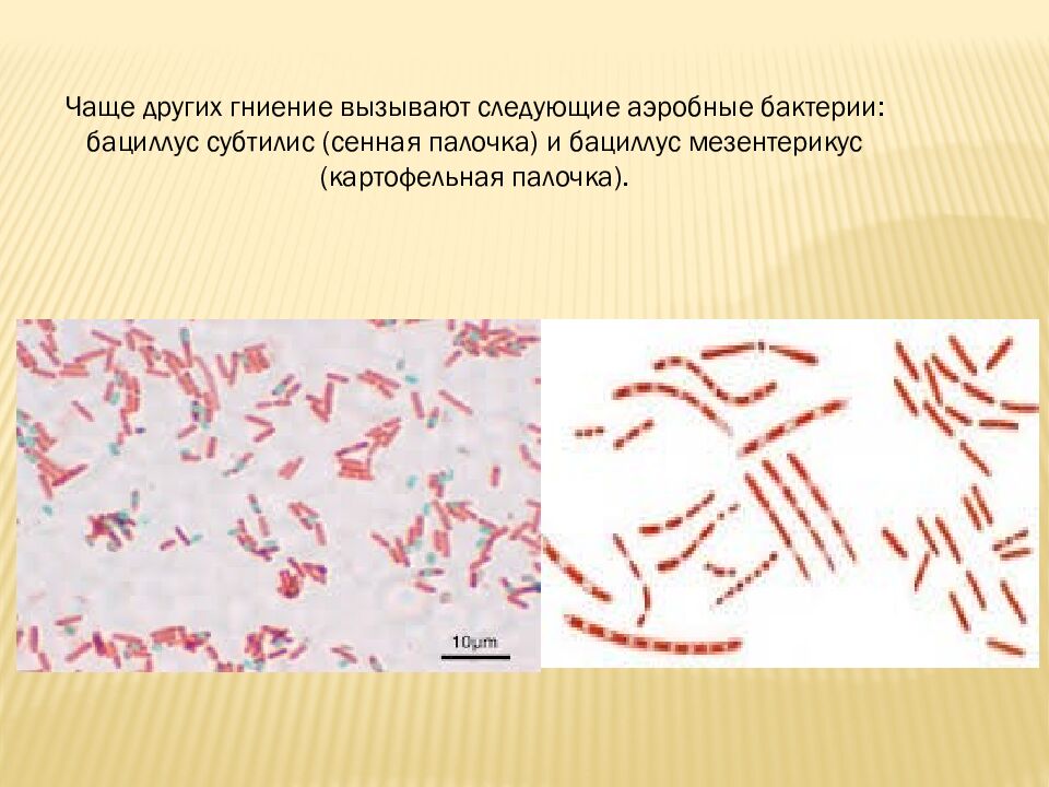 презентация: Тема: «ВИДЫ БАКТЕРИЙ»