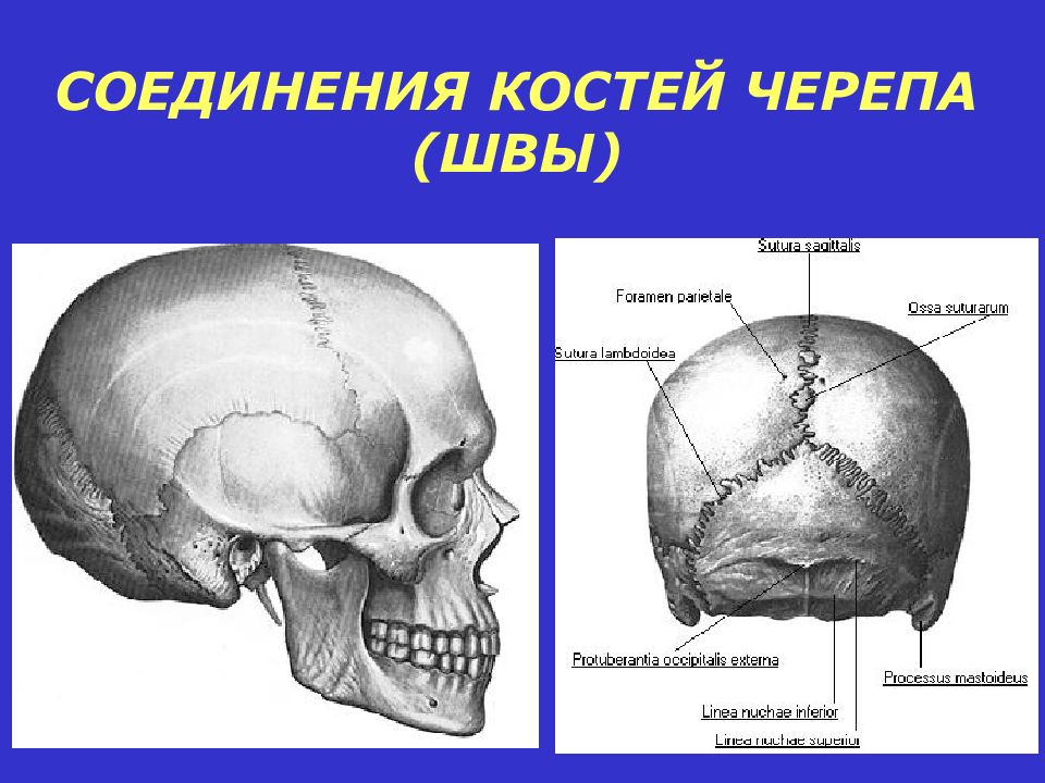 Подвижное соединение в черепе. Швы костей черепа анатомия. Кости свода черепа костные швы. Соединение костей свода черепа. Соединение костей черепа анатомия.