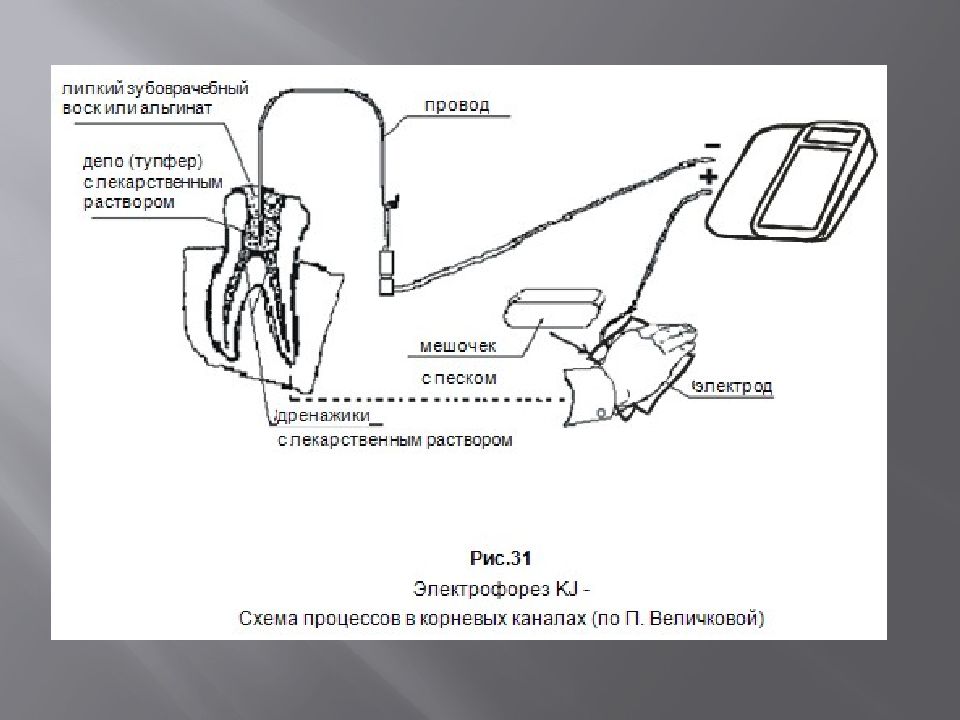 Электрофорез в стоматологии презентация